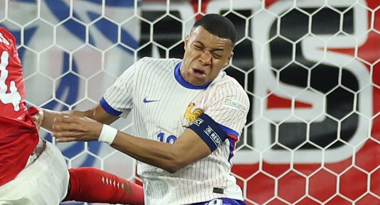 Mbappé nariz